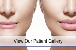 View Our Patient Gallery