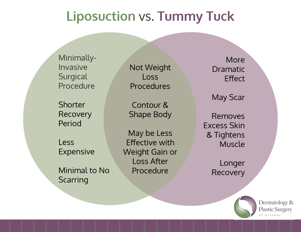 Tummy Tuck and Liposuction treatment Tucson