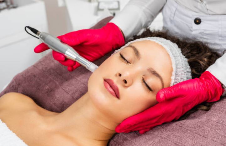 Microneedling with PRP Tucson